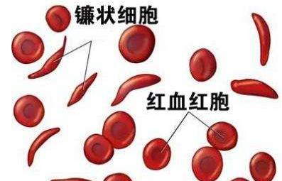 人体黄色茄子视频厂家介绍检测微量元素的仪器 人体黄色茄子视频厂家介绍检测微量元素的仪器